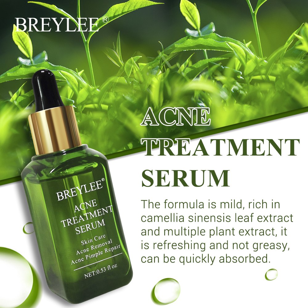 Acne-No-More — Breylee Anti-Acne Treatment Serum