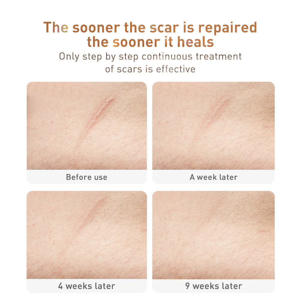 Scar-let Letter — Traditional Scar Removal Cream, 30g