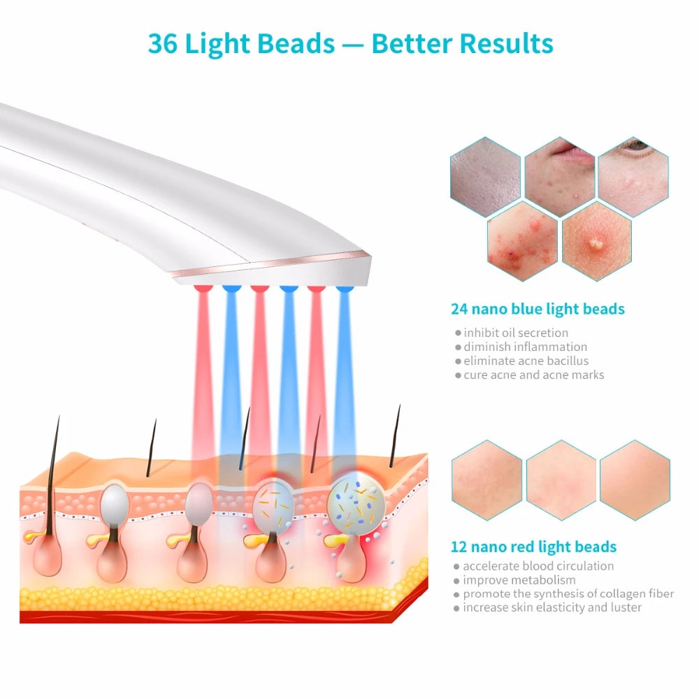 Acne-tually Gone — Wireless Blue & Red Light Therapy Device