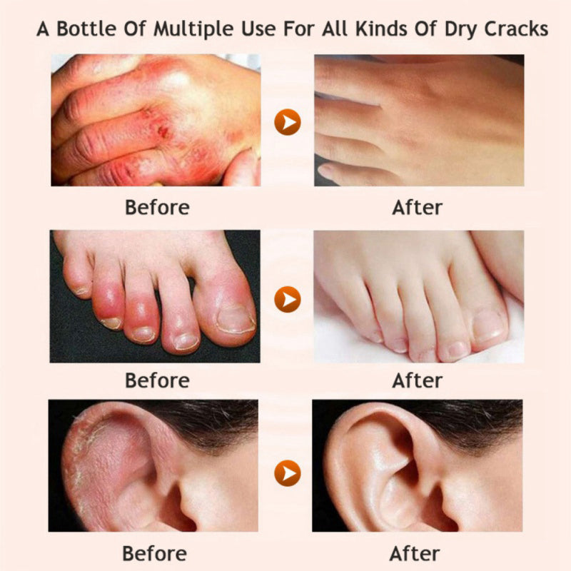 Honey, Honey — Moisturizing Cream for Feet & Legs