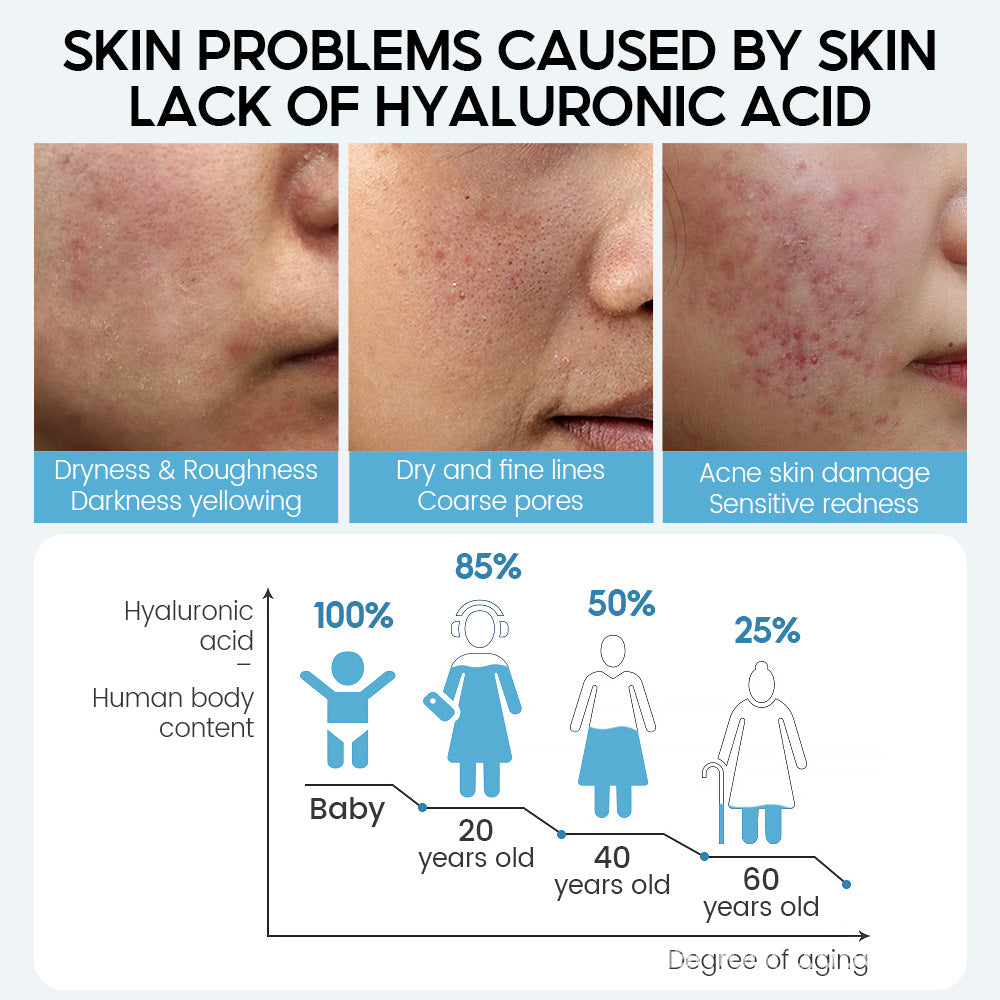 Hyaluron-IC! — Hydrating Anti-Aging Face Serum with Pore Shrinking Benefits