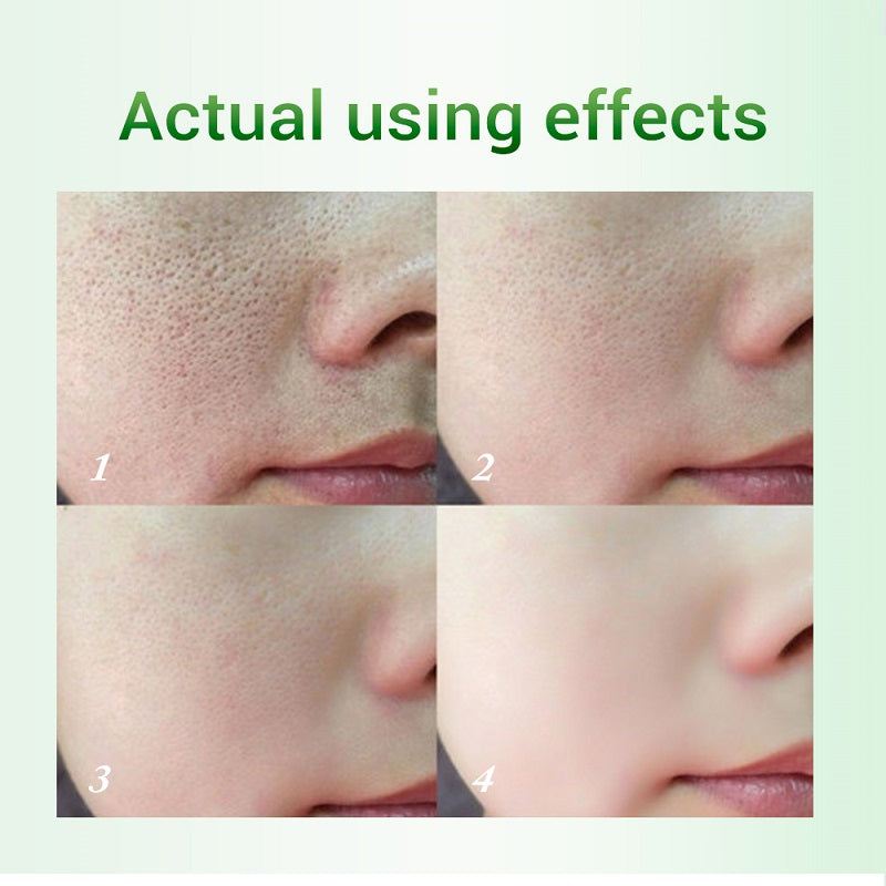 Pore-fect Match — Salicylic Acid Pore Refining Cream